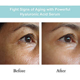 JOYAL BEAUTY Hyaluronic Acid Serum for Face Lips Eyes. 100% Pure Anti-Aging Serum for Skin Care. 2 Types of Hyaluronic Acid with High & Low Molecular Weight to Maximize Absorption and Hydration