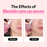 ISOI Blemish Care Up Serum 15ml + ISOI Blemish Care Spot Cream 25ml