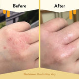 ECZEMA HONEY Original Skin-Soothing Cream - Organic Hand & Body Eczema Relief - Natural Honey Lotion for Dry, Itchy, & Irritable Skin (4 Oz)