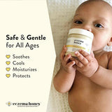 ECZEMA HONEY Original Skin-Soothing Cream - Organic Hand & Body Eczema Relief - Natural Honey Lotion for Dry, Itchy, & Irritable Skin (4 Oz)